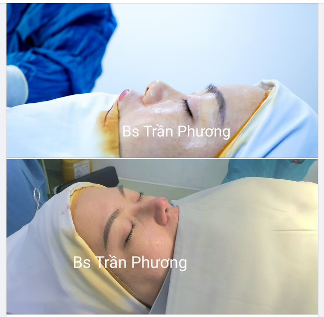 Bác sĩ chắc chắn phải là người làm cho em nhé.
