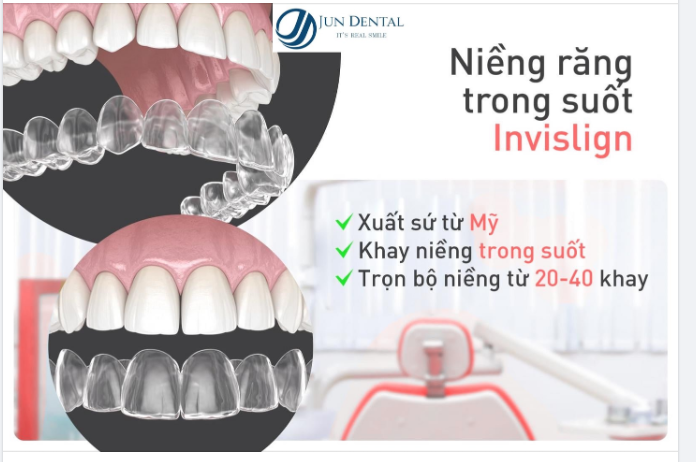 Bạn đã biết tới phương pháp niềng răng trong suốt của Jun Dental chưa?