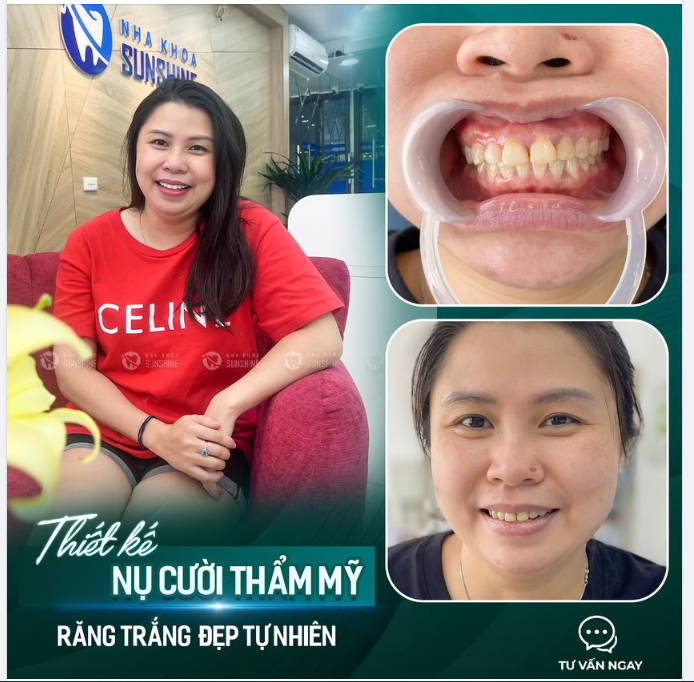 Bạn đang tò mò về quy trình khi thực hiện phương pháp thẩm mỹ này