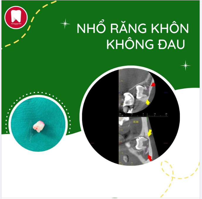 BÀN TAY VÀNG TRONG LÀNG NHỔ RĂNG