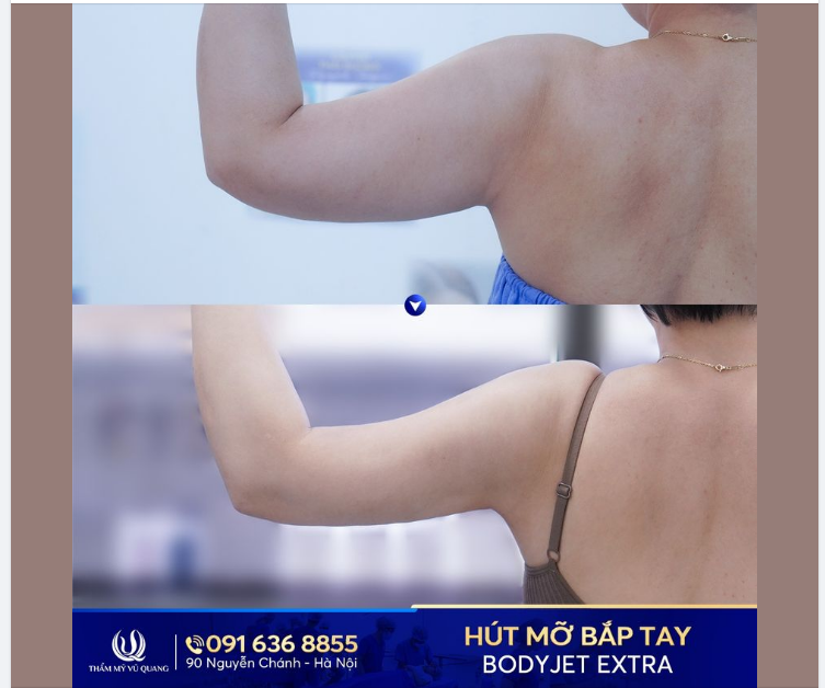 BẮP TAY THON GỌN - THU TRỌN ÁNH NHÌN