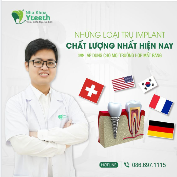 BẬT MÍ NHỮNG LOẠI TRỤ IMPLANT NÊN "ĐẦU TƯ" NHẤT!