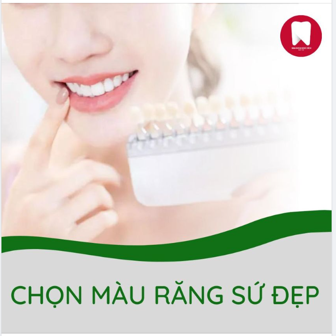 BÍ QUYẾT CHỌN MÀU RĂNG SỨ ĐẸP