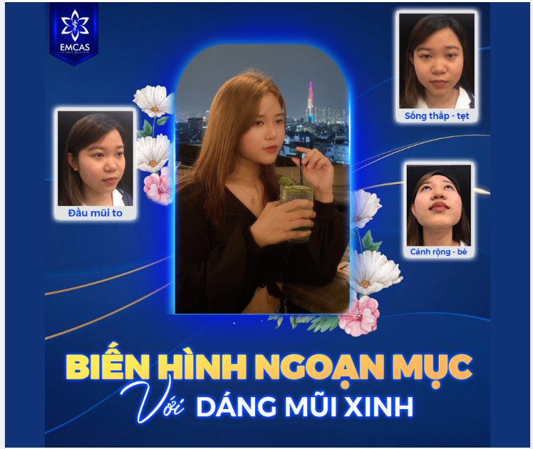 BIẾN HÌNH NGOẠN MỤC VỚI DÁNG MŨI XINH