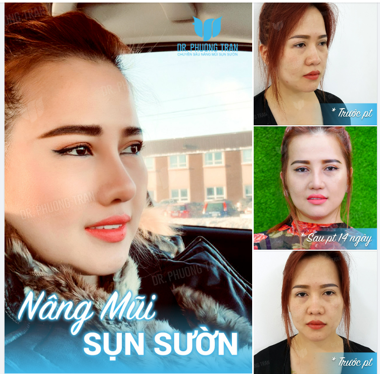 Bình thường mình hơi cục súc. Mà khi hạnh phúc thì mình cute…