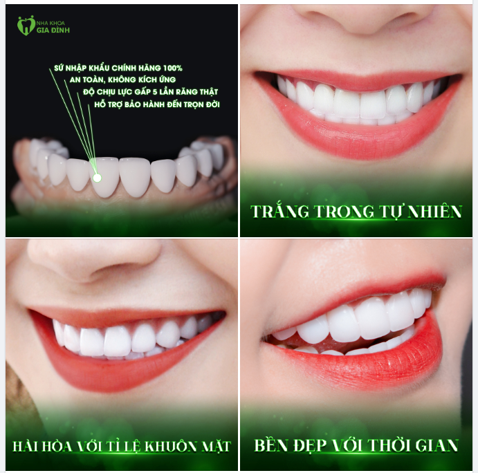 BỌC RĂNG SỨ CHÍNH HÃNG CAO CẤP – BỀN ĐẸP ĐẾN TRỌN ĐỜI