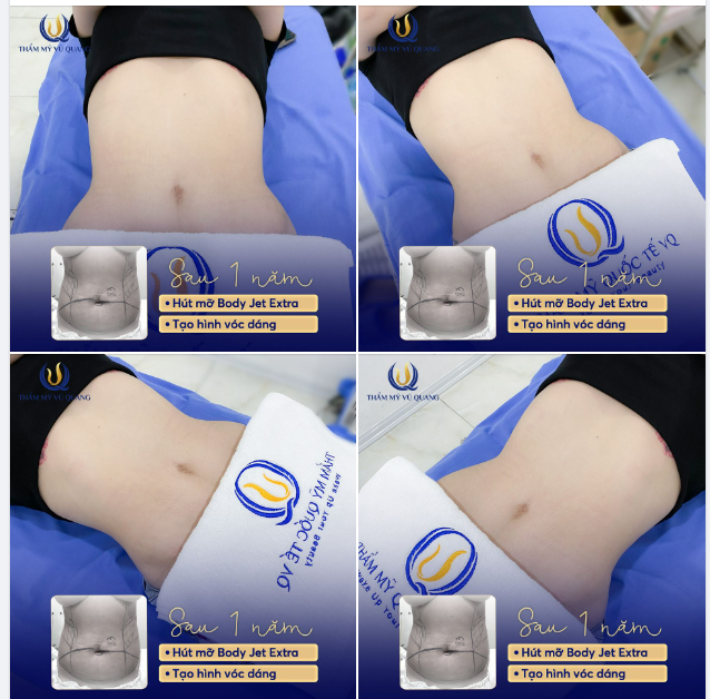 Bụng cực xinh - cho dáng thật lung linh