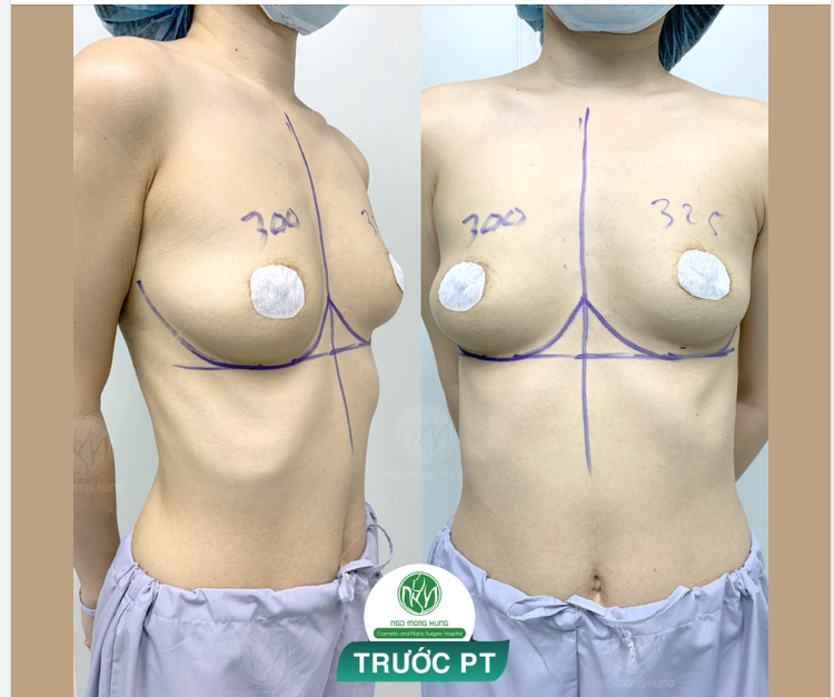 CA NGỰC NỘI SOI NGÀY CUỐI TUẦN CHỦ NHẬT