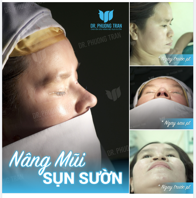 Các bạn nhất định phải NHÌN LÔNG MÀY nha không lại nghĩ đây là 2 người khác nhau.