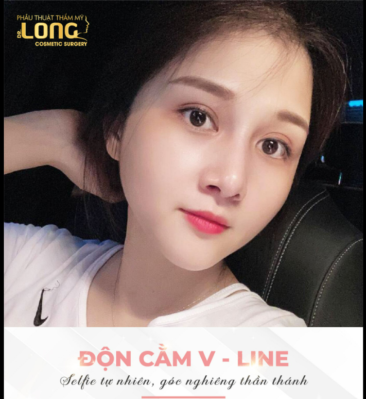 Cằm V-line chuẩn Idol xứ Hàn giúp nàng thêm đẹp
