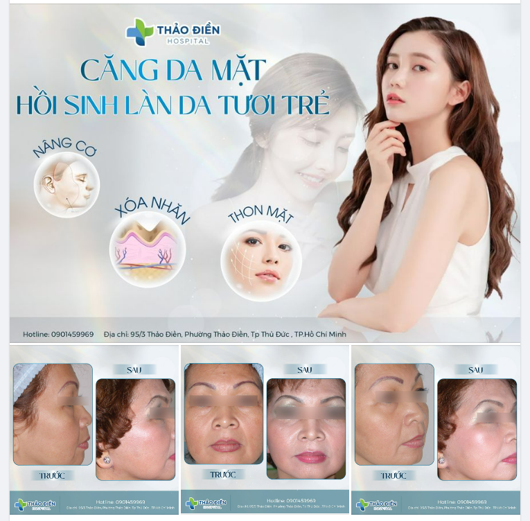 CĂNG DA MẶT - HỒI SINH LÀN DA TƯƠI TRẺ