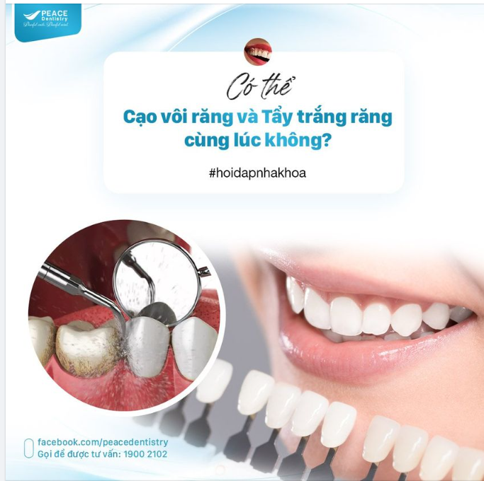  Cạo Vôi Răng và  Tẩy Trắng Răng là hai dịch vụ nha khoa phổ biến