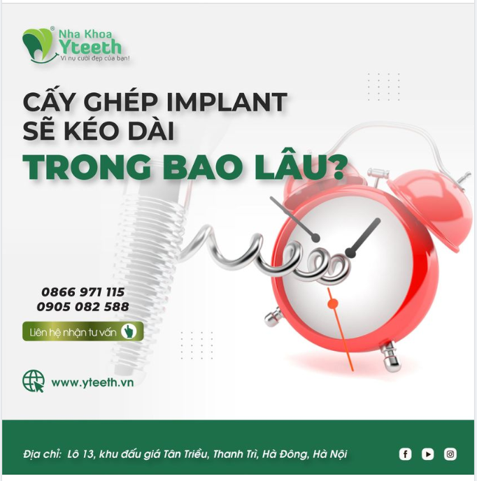 CẤY GHÉP IMPLANT SẼ KÉO DÀI TRONG BAO LÂU?