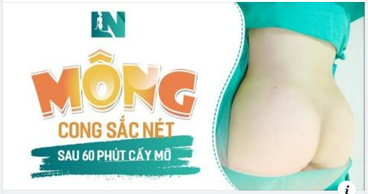 Cấy mỡ tạo dáng - bí quyết vòng 3 ĐẸP cong sắc nét.