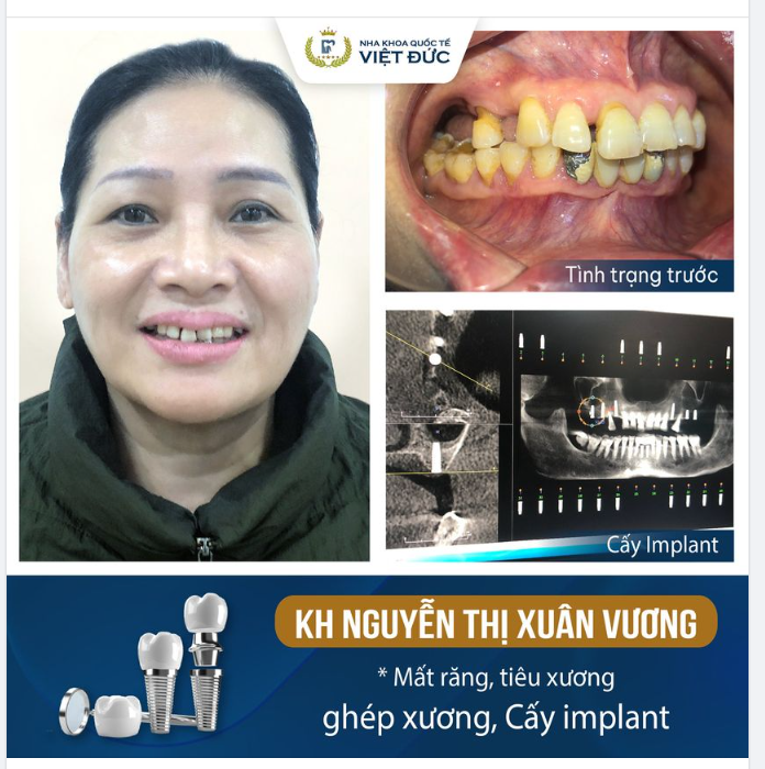 CHẲNG ĐIỀU GÌ TUYỆT VỜI BẰNG SỨC KHỎE!