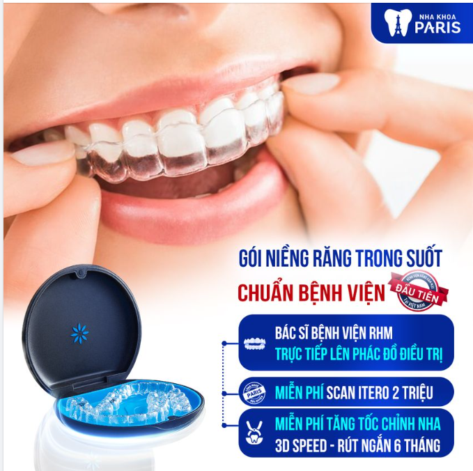 CHỈ CÓ TẠI NHA KHOA PARIS - ĐỘC QUYỀN VIỆT NAM