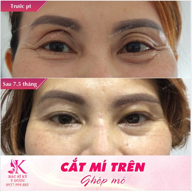 Chị khách sinh sống tại TPHCM. Miền đất mà bấy lâu việc làm đẹp đã không còn xa lạ và trở thành một phần thiết yếu hằng ngày của phụ nữ nói riêng và mọi người nói chung.