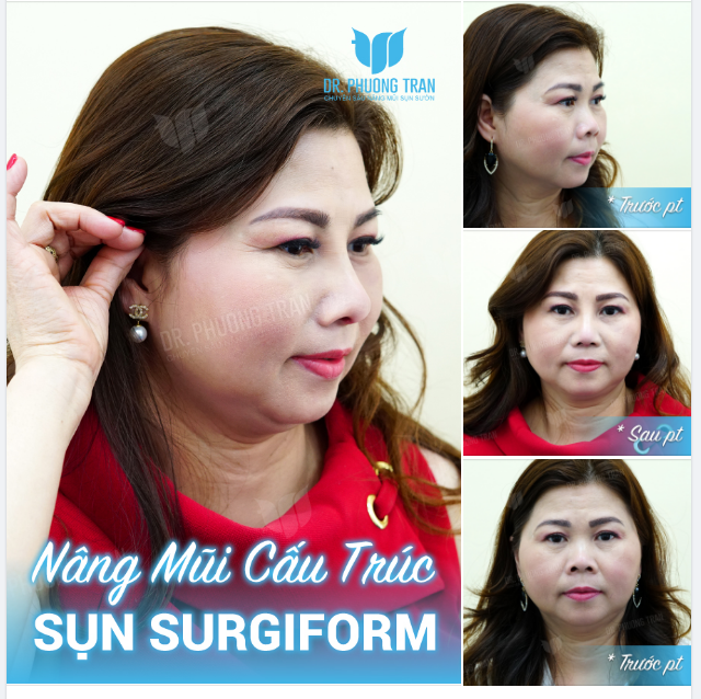 CHỊ NĂM NAY BAO TUỔI – CHỊ 18+