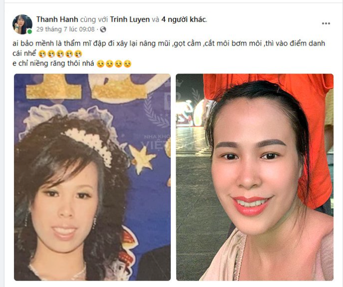 CHỈ NIỀNG RĂNG THÔI MÀ THAY ĐỔI NHIỀU QUÁ!
