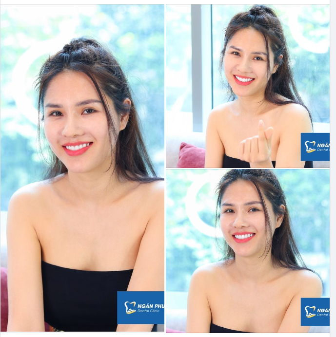 Chiếm trọn spotlight với dòng sứ đến từ Hoa Kỳ