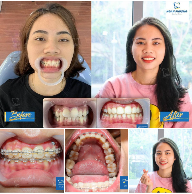 Chúc mừng Hương với hành trình 3 năm 3 tháng của mình.