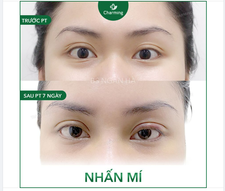 Chụp tấm ảnh cho bạn mà Charming run cả tay
