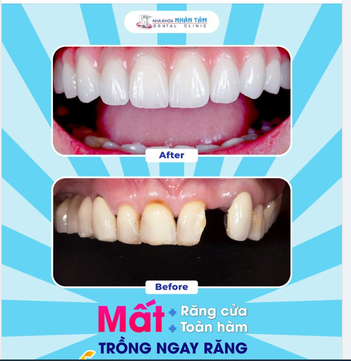 “CÔ CHỈ ƯỚC MÌNH CÓ MỘT HÀM RĂNG CHẮC KHỎE ĐỂ ĂN NHAI”