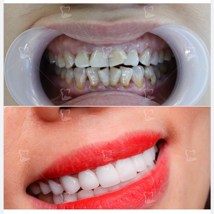 Có những nụ cười được vun đắp từ những sự quyết tâm