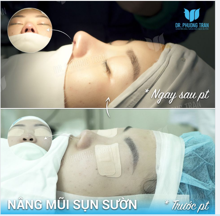 Có thể những người ngoài kia đang xầm xì ghen tị “Ôi đắp toàn đồ giả lên người rồi ít năm sau thấy cảnh”.