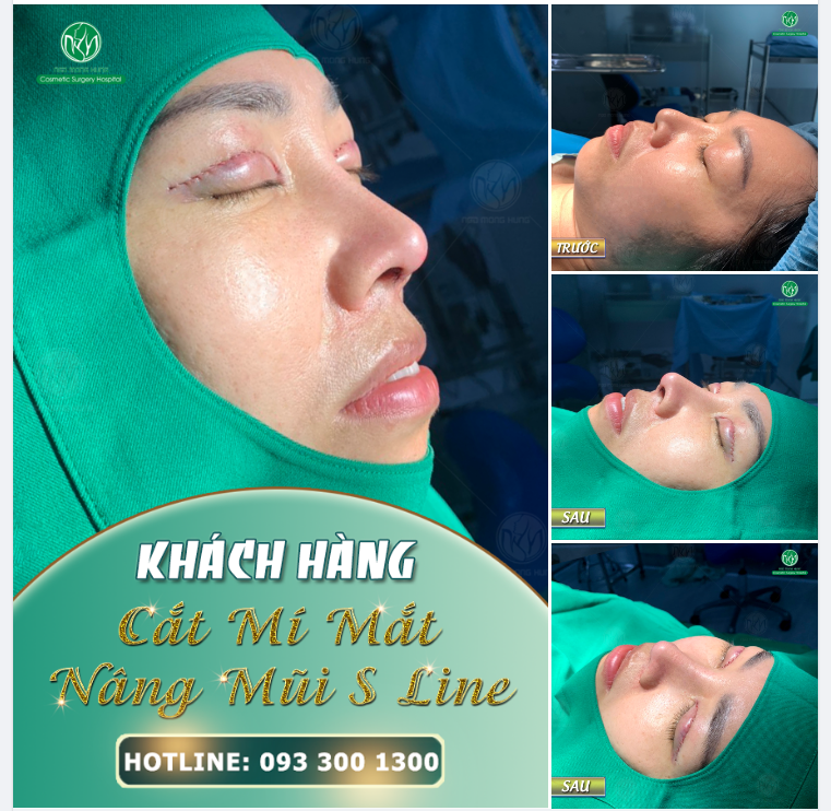 COMBO MANG LẠI VẺ ĐẸP HOÀN THIỆN CHO KHUÔN MẶT
