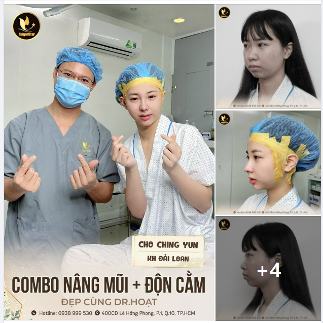 COMBO NÂNG MŨI + ĐỘN CẰM ĐẸP CÙNG DR. HOẠT
