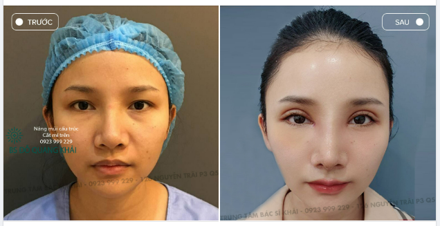 COMBO NHIỀU KHÁCH HÀNG LỰA CHỌN NHẤT 2022
