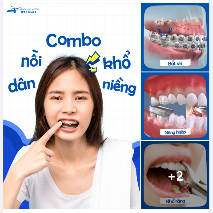 COMBO “NỖI KHỔ” DÂN NIỀNG