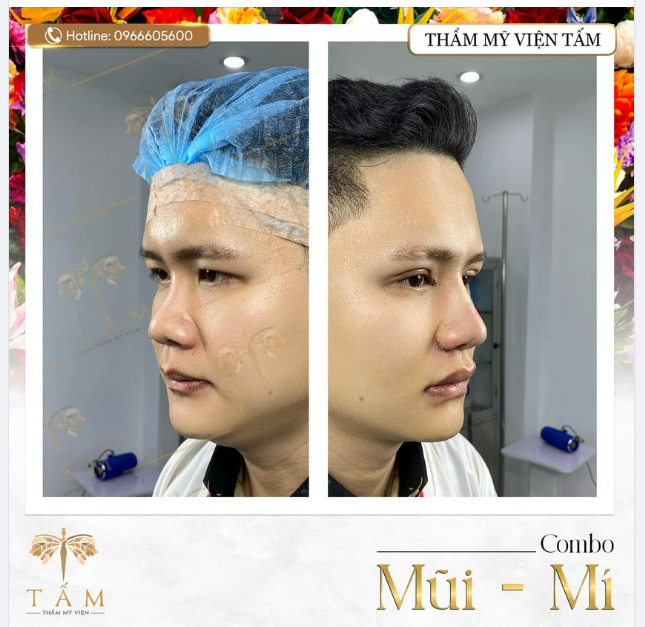 Combo thay đổi toàn diện gương mặt