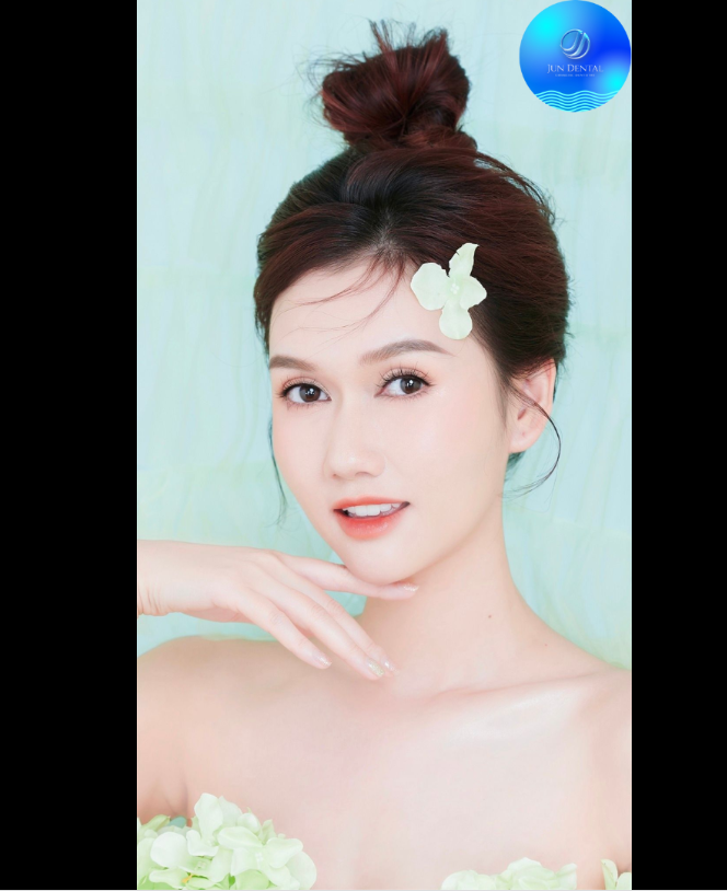 CỨ SỢ NÀY SỢ KIA THÌ KHI NÀO RĂNG MỚI ĐẸP LÊN ĐƯỢC