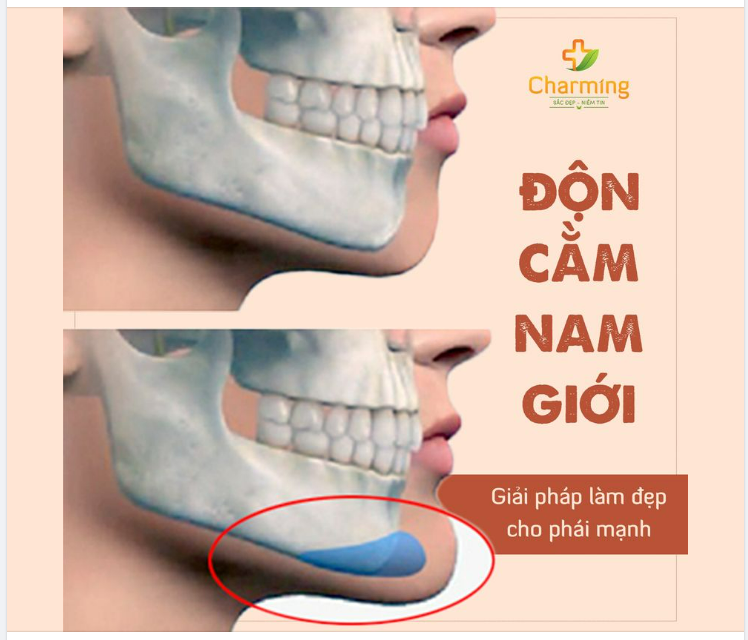 CƯA ĐỔ CRUSH NHỜ… ĐỘN CẰM