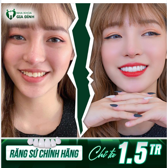 CŨNG ĐẾN LÚC BẠN NÊN TÂN TRANG LẠI HÀM RĂNG CỦA MÌNH