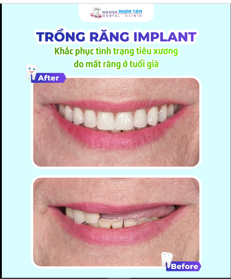 “Đã lâu cô không có được cái cảm giác ăn uống một cách tự tin như vậy”