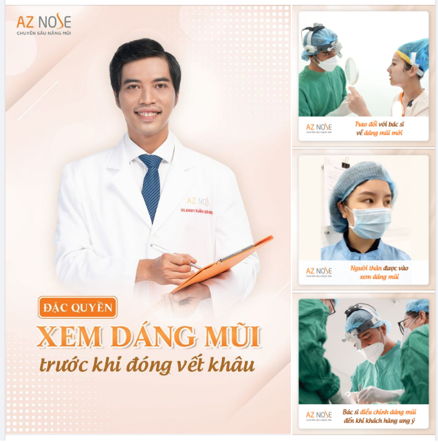 Đặc quyền xem dáng mũi tại AZ NOSE có gì đặc biệt