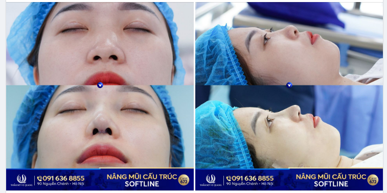 Đắn đo 2 năm - Thực hiện 1h - Kết quả bất ngờ