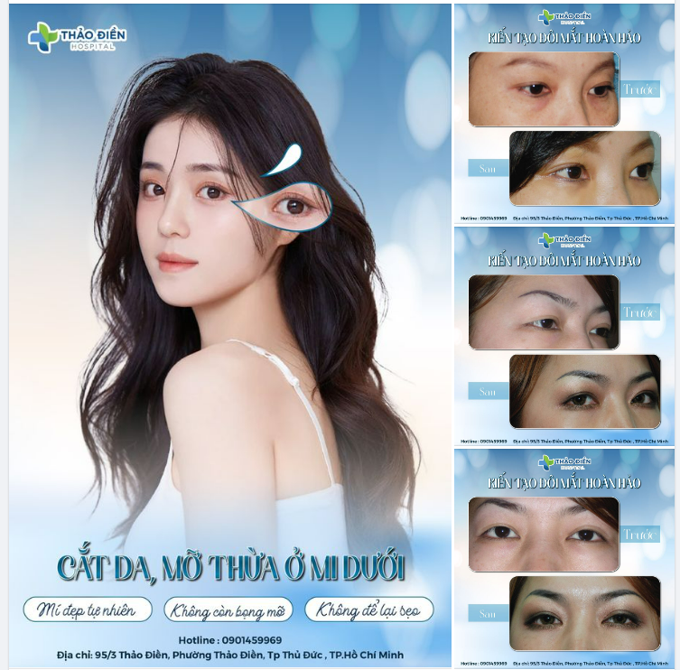 Đánh bại kẻ thù làm đôi mắt trở nên nặng nề, buồn ngủ!
