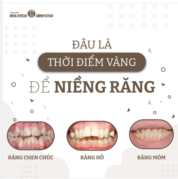 ĐÂU LÀ "THỜI ĐIỂM VÀNG" ĐỂ NIỀNG RĂNG.