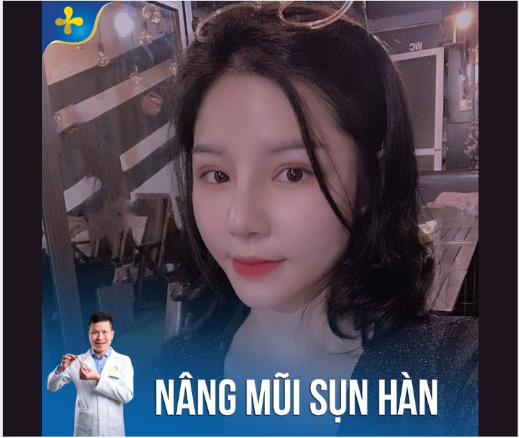 Để có ĐƯỢC dáng mũi cao bay, thanh tú làm bừng sáng cả gương mặt, theo chị em là lời hay lỗ ạ