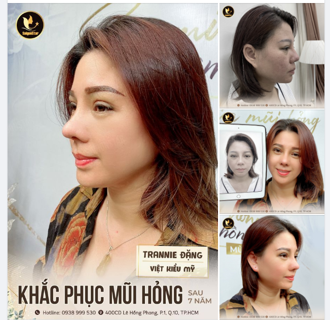 Hợp phong thủy: Như một cây cầu nối giữa con người và sang thế giới bên kia, phong thuỷ là yếu tố không thể thiếu để giao hòa và hòa nhập với môi trường xung quanh. Tiếp cận phong thuỷ và sử dụng dịch vụ hợp phong thuỷ là cách thức hòa quyện với sự tài lộc, may mắn và hạnh phúc.