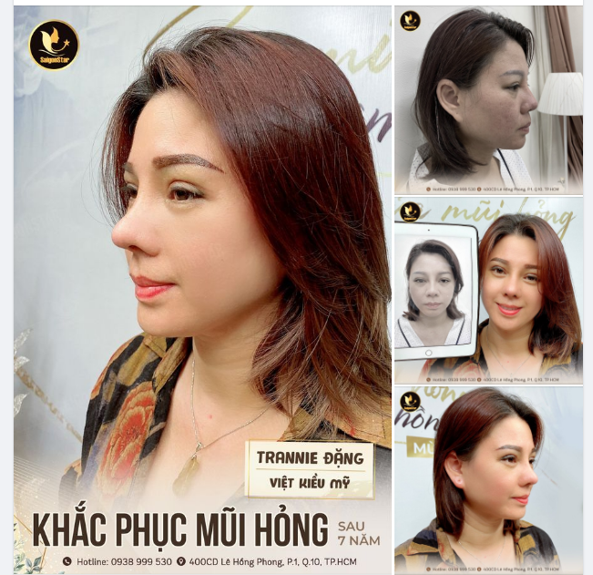 ĐẸP TOÀN DIỆN – HỢP PHONG THỦY CÙNG VIỆT KIỀU MỸ