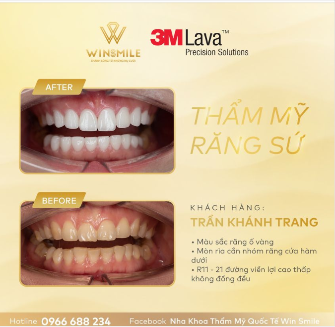 ĐÍCH ĐẾN CỦA GU THẨM MỸ TINH TẾ