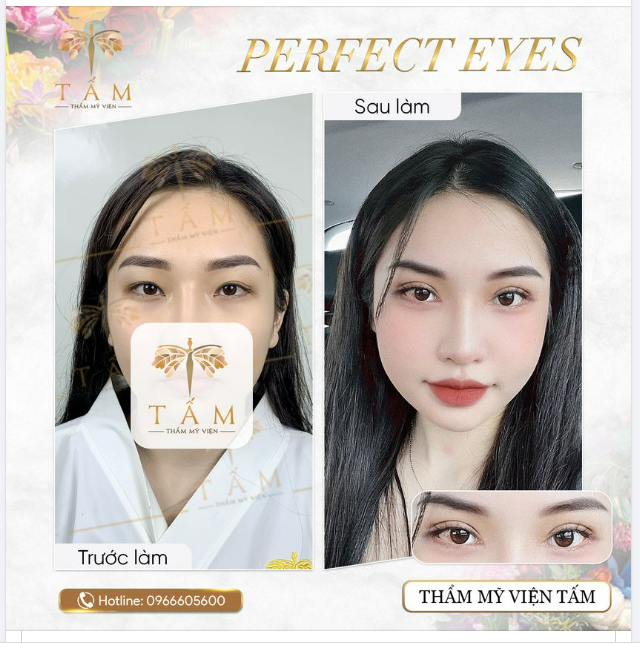 Đôi mắt đẹp tự nhiên cungfPerfect Eyes 