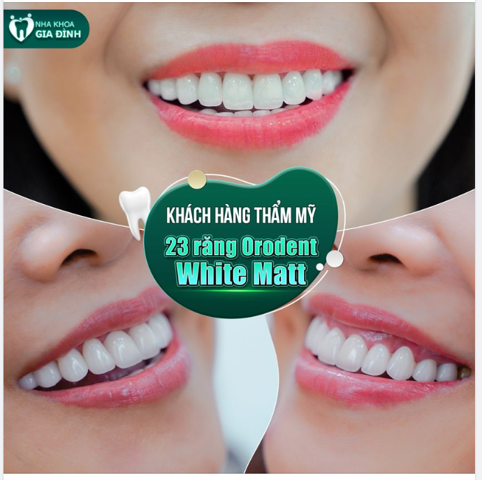 DÒNG SỨ ORODENT CÓ BẢO HÀNH LÊN TỚI 19 NĂM
