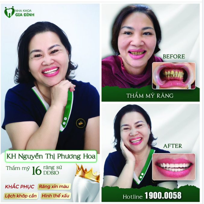 Đưa ta về thanh xuân - Bằng những nụ cười xinh ban đầu...