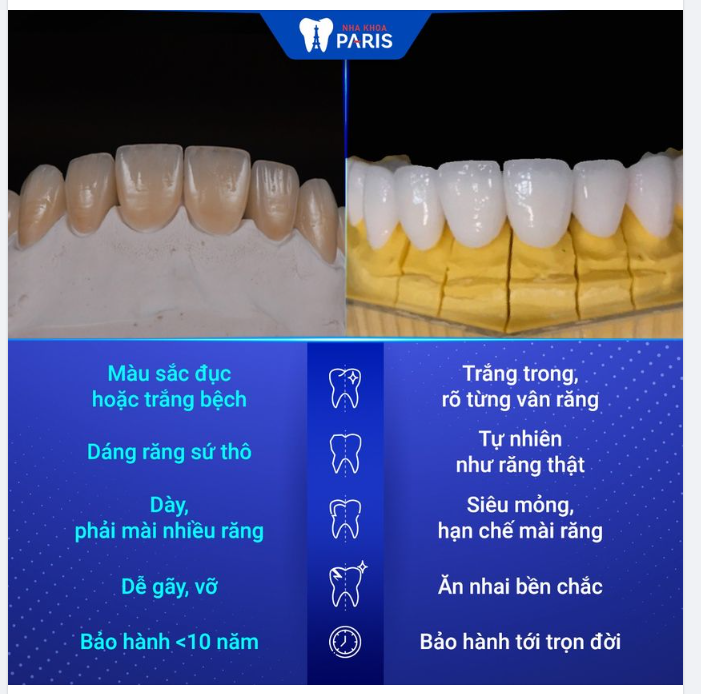ÉT Ô ÉT: 200k/1 răng toàn sứ đức là hàng FAKE, tại Nha khoa Paris không nhận làm!!!